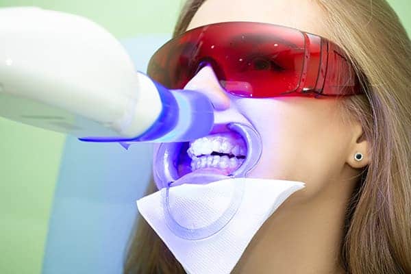 Laser teeth whitening treatments Hertfordshire