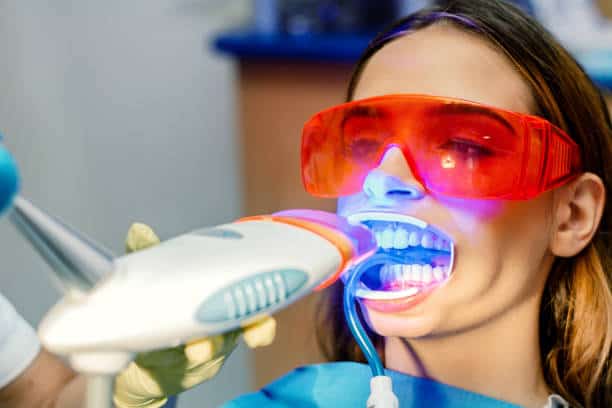 Simplifying Teeth Whitening: A Comprehensive Guide Hertfordshire