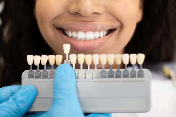 Laser Teeth Whitening: Exploring the Longevity of Your Brighter Smile Hertfordshire