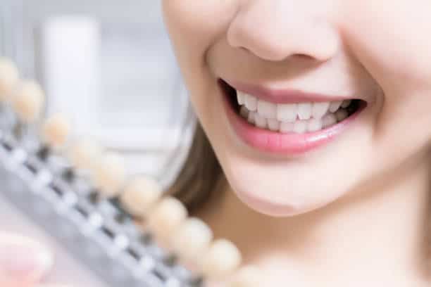 Teeth Whitening Kings Norton Hertfordshire